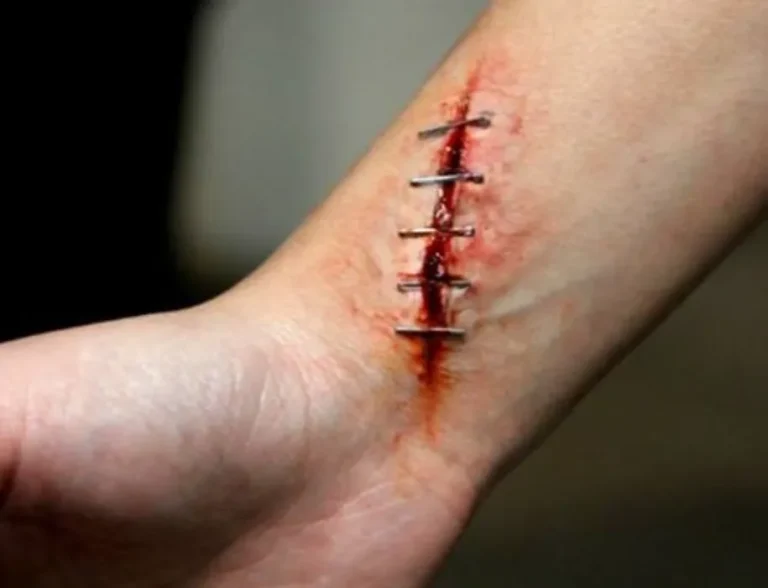 special effects (7)